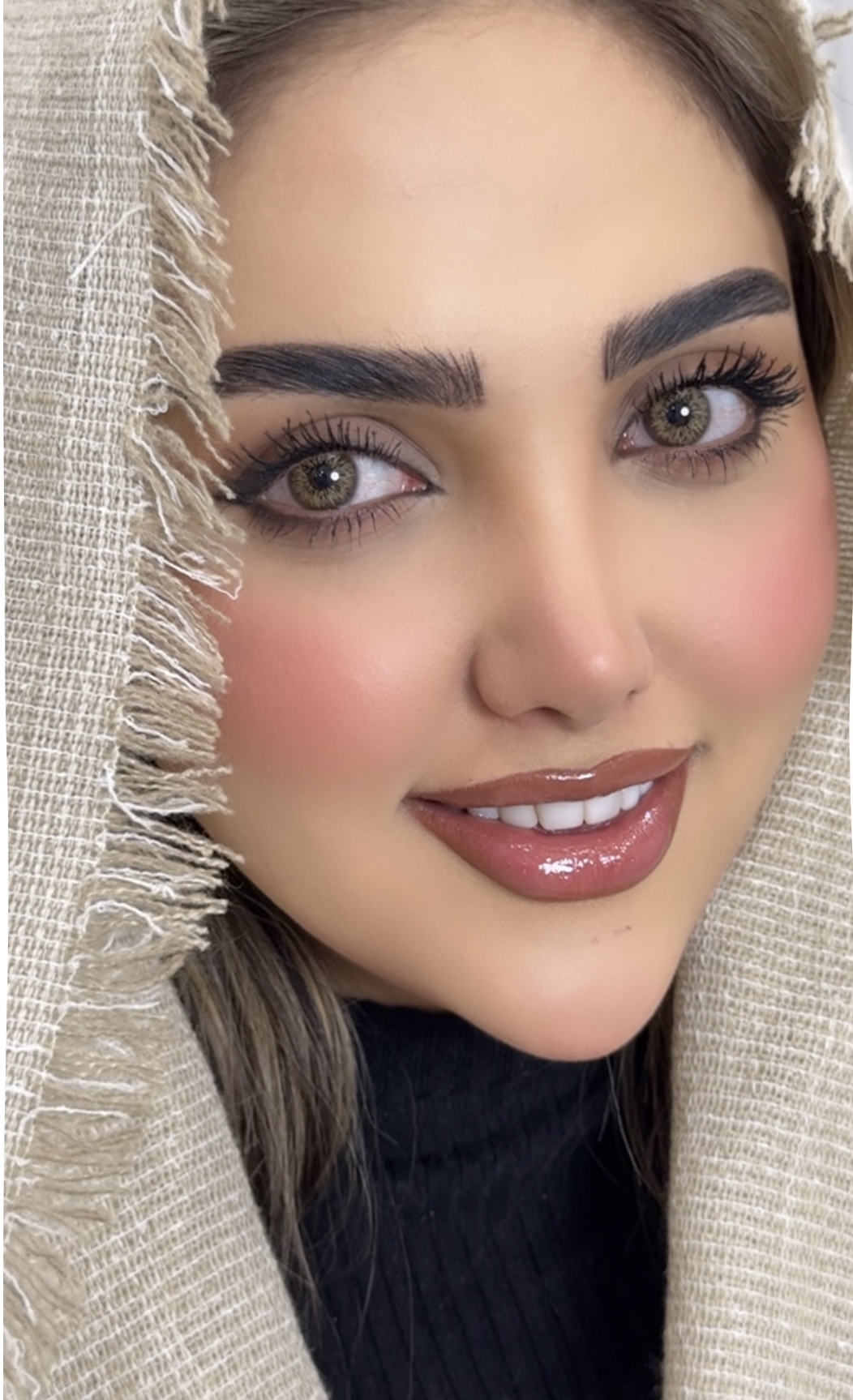 عسلی مویرگی